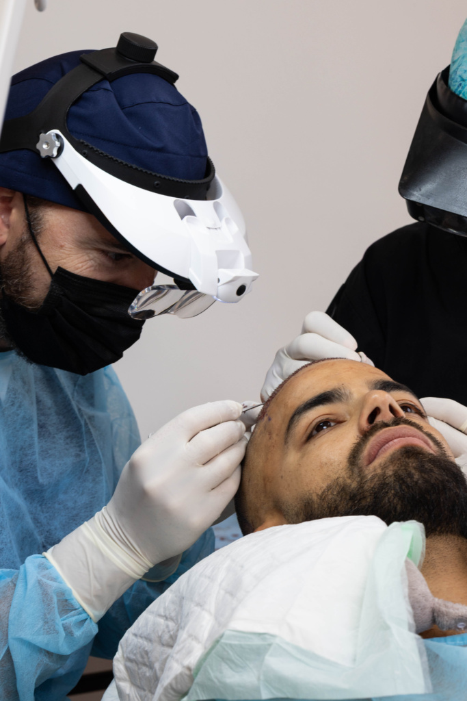 Greffe capillaire FUE Bordeaux 12 greffe 271