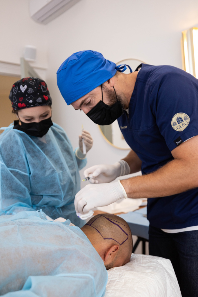 Greffe capillaire FUE Bordeaux 9 greffe 38